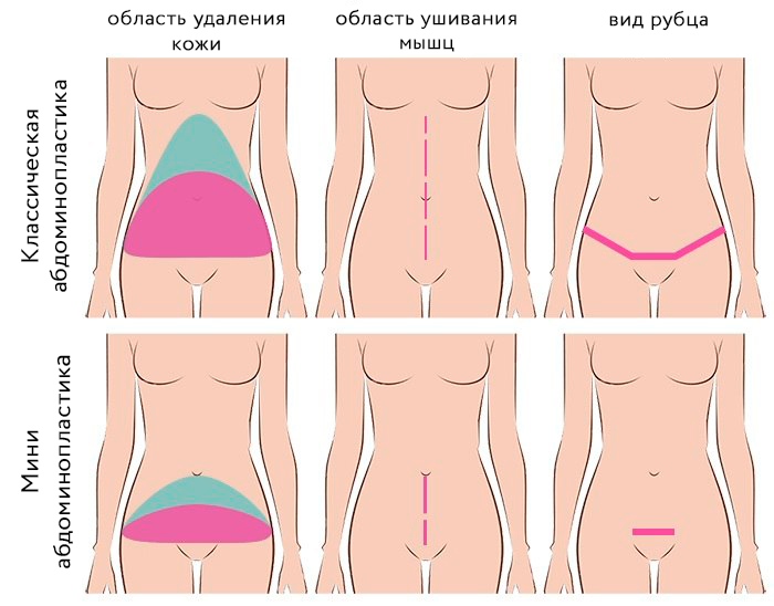 миниабдомино и классика.jpg